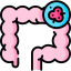 Colorectal Cancer treatment
